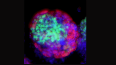 صورة جامعة الملك عبد الله للعلوم.. استخدام الخلايا الجذعية المزروعة في المختبر في دراسة التطور الجنيني