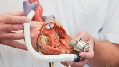 صورة “قلب اصطناعي” أقرب إلى القلب الطبيعي قد ينجح في أن يحل محل القلب الطبيعي