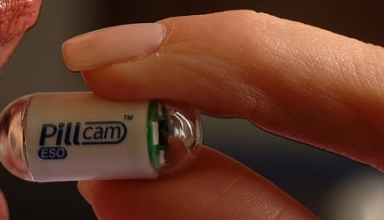 صورة “كبسولة الكاميرا” طريقة مبتكرة لاكتشاف وتشخيص سرطان الأمعاء