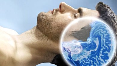 صورة بالجمع بين التصوير بالرنين وتخطيط كهربية الدماغ.. فريق علمى سويسري يتمكن من حل لغز نشاط الدماغ أثناء النوم