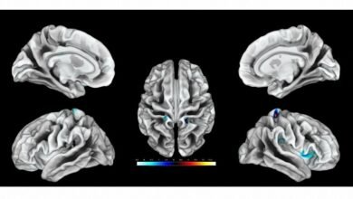 صورة دراسة أمريكية تكشف النقاب عن مرحلة دماغية غريبة تسبق وفاة الإنسان