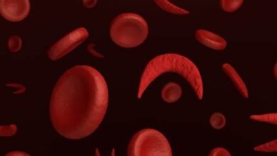 صورة “الخلايا السمية الهدبية”.. أحدث علاجات فقر الدم المنجلي بالسعودية