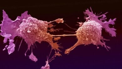 صورة دراسة: خفض درجة حرارة الخلايا السرطانية إلى 68 درجة فهرنهايت يمكن أن يوقف نمو سرطانات الدماغ