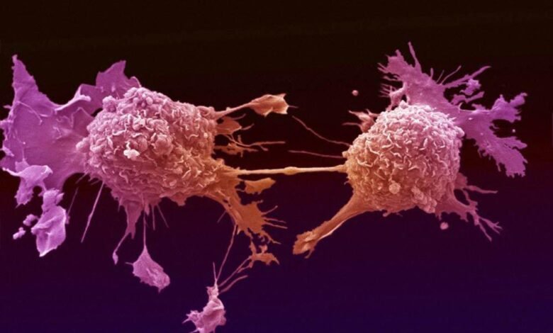 دراسة: خفض درجة حرارة الخلايا السرطانية إلى 68 درجة فهرنهايت يمكن أن يوقف نمو سرطانات الدماغ