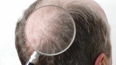 صورة هرمون في شعر الانسان يتنبأ بمخاطر الإصابة بأمراض القلب !