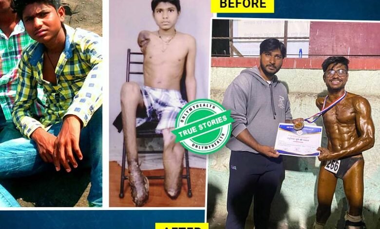 كيف ذهب الهندي "سوراج جايوال" للفوز بألقاب في مسابقات كمال الأجسام مع الأرجل الاصطناعية؟