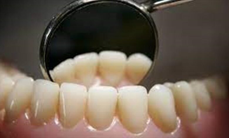 الأشخاص الذين يبدأون بفقدان أسنانهم.. أكثر عرضة للإصابة بالخرف والضعف الإدراكي