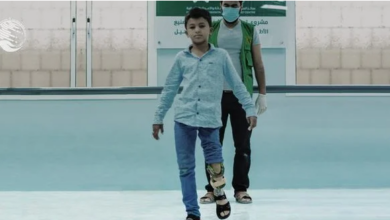 صورة الطفل اليمني (قيس فياض).. ورحلة معاناة مع القدم المشوّهة
