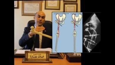 صورة د. خالد عمارة يكتب: طبيب العظام وقوة الملاحظة